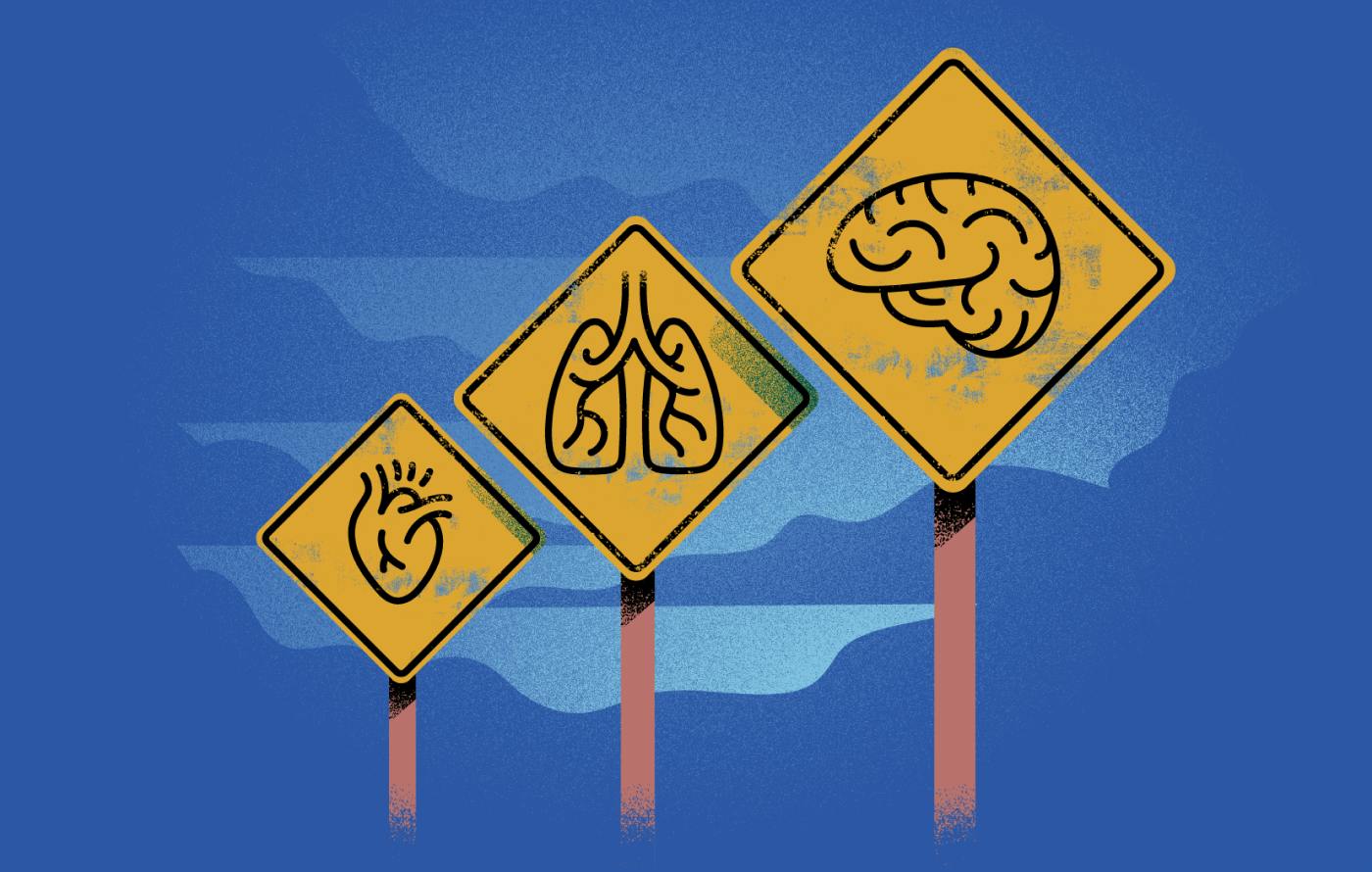 Bouncing forward with resilience
